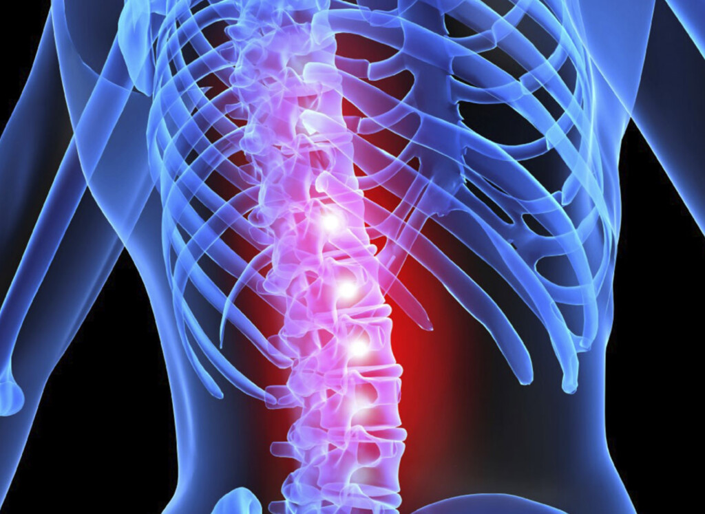 image of a spine highlighted with red lights