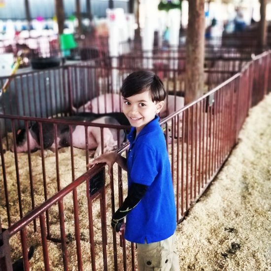 jai stood at a petting zoo smiling at the camera wearing a blue t shirt and his dmo glove