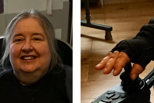Janet smilling at the camera and janet's hand in a glove side by side in a collage